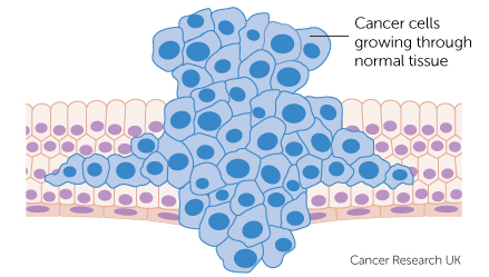 कर्करोग रोगाविषयी माहिती